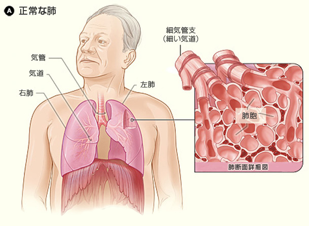image_a 図A:健康な人の肺と肺胞